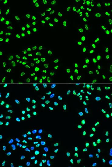 Immunocytochemistry/ Immunofluorescence: ATR [p Ser428] Antibody - Azide and BSA Free [ATR] - Immunofluorescence analysis of U2OS cells using ATR Rabbit pAb  at dilution of 1:100. Secondary antibody: Cy3-conjugated Goat anti-Rabbit IgG (H+L)  at 1:500 dilution. Blue: DAPI for nuclear staining.