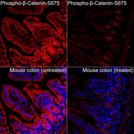 Immunocytochemistry/ Immunofluorescence: beta-Catenin [p Ser675] Antibody - Azide and BSA Free [beta-Catenin] - Immunofluorescence analysis of Mouse colon(treated with lambdaPP) and Mouse colon(untreated) tissue using beta-Catenin Rabbit pAb  at a dilution of 1:100 (40x lens). Secondary antibody: Cy3-conjugated Goat anti-Rabbit IgG (H+L) at 1:500 dilution. Blue: DAPI for nuclear staining. High pressure antigen retrieval performed with 0.01M Citrate Buffer (pH 6.0) prior to IF staining.