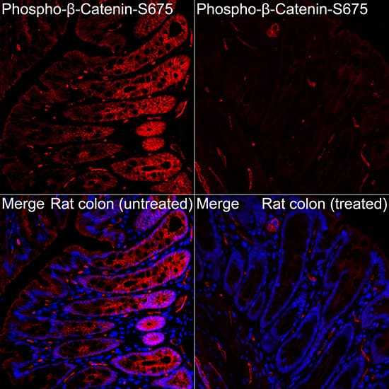 Immunocytochemistry/ Immunofluorescence: beta-Catenin [p Ser675] Antibody - Azide and BSA Free [beta-Catenin] - Immunofluorescence analysis of Rat colon(treated with lambdaPP) and Rat colon tissue using beta-Catenin Rabbit pAb  at a dilution of 1:100 (40x lens). Secondary antibody: Cy3-conjugated Goat anti-Rabbit IgG (H+L) at 1:500 dilution. Blue: DAPI for nuclear staining. High pressure antigen retrieval performed with 0.01M Citrate Buffer (pH 6.0) prior to IF staining.