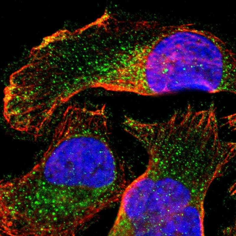 Immunocytochemistry/ Immunofluorescence FATP4/SLC27A4 Antibody - BSA Free