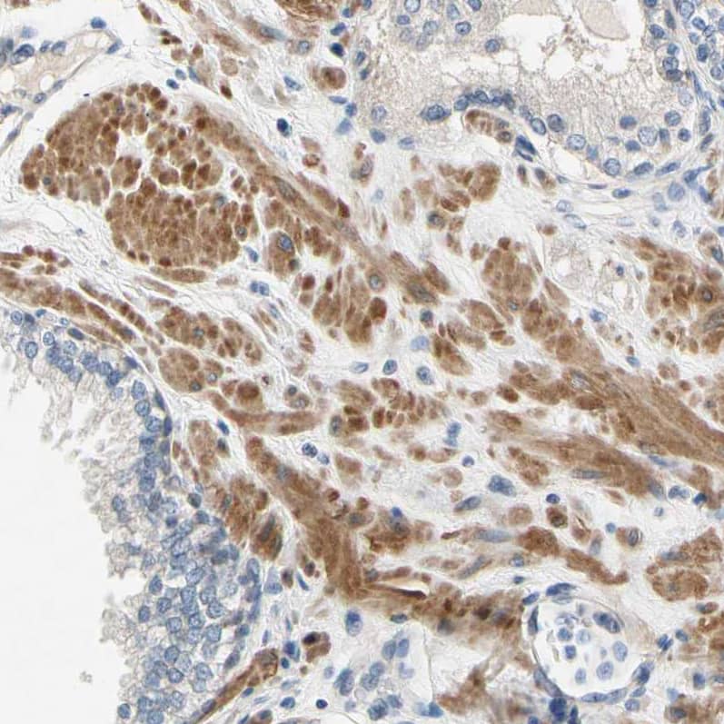 Immunohistochemistry-Paraffin FATP6/SLC27A6 Antibody - BSA Free