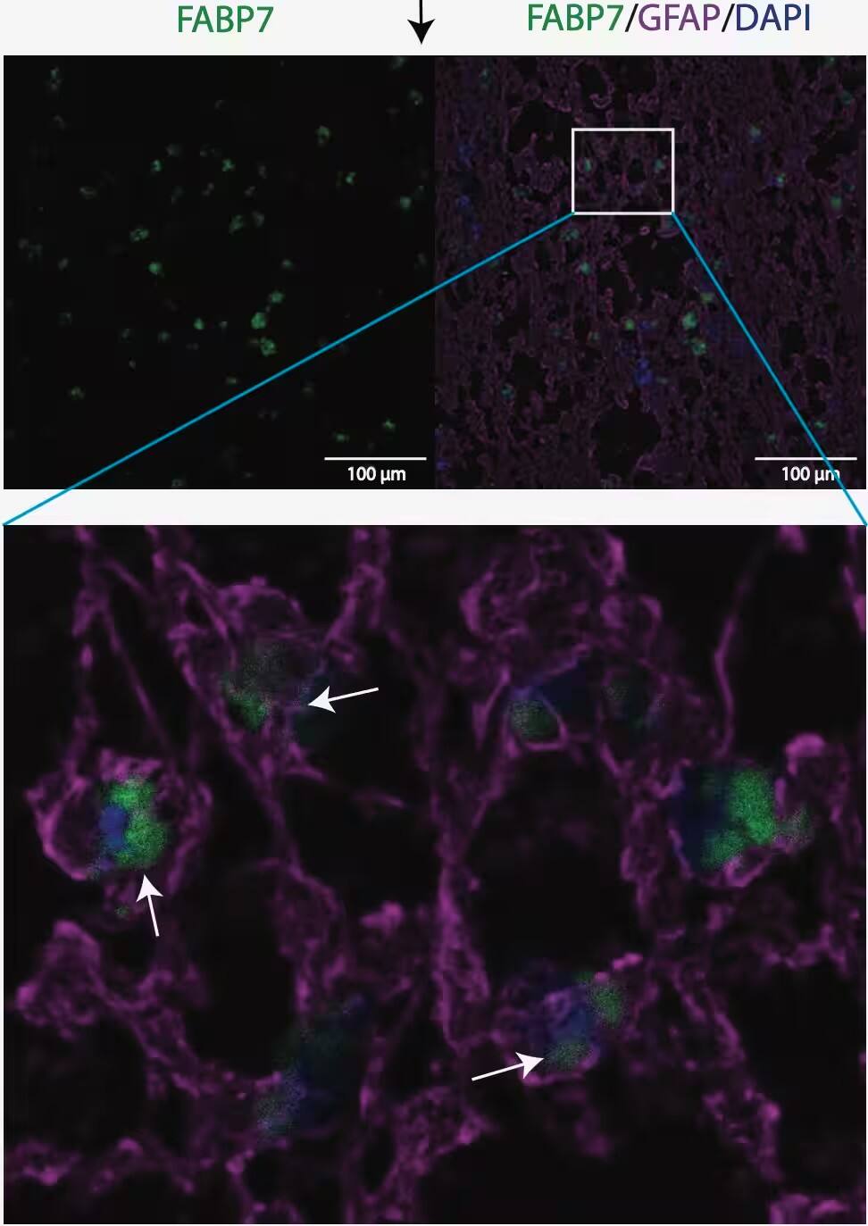 FABP7 is increased in progressive multiple sclerosis and induces a pro-inflammatory phenotype in monocytes through a glycolytic switch. Image from a verified customer review.
