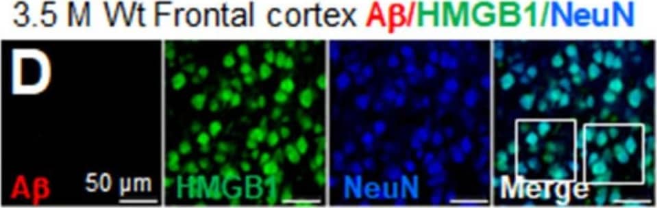 Cellular and subcellular localization of HMGB1 in the frontal cortices of 3.5 M Tg-APP/PS1 and age-matched control mice: Coronal brain sections were prepared from 3.5 M Tg (G–L) and age-matched control (A–F) mice, and triple-immunofluorescence staining was conducted with anti-A beta , anti-HMGB1, and anti-Iba1 (A–C,G–I) or anti-A beta , anti-HMGB1, and anti-NeuN (D–F,J–L) antibodies. Arrows indicate anti-HMGB1 immunoreactivity in microglia (B,C,H,I) or NeuN-negative cells (E,F,K,L). Arrowheads indicate anti-HMGB1 immunoreactivity in neurons (E,F,K,L) or Iba1-negative cells (H,I). The double arrow in (H) indicates anti-HMGB1 immunoreactivity in the cytoplasm of microglia, and the double arrowhead in (I) indicates anti-HMGB1 immunoreactivity in the cytoplasm of Iba1-negative cells (neurons). Scale bars represent 20 or 50 um. Image collected and cropped by CiteAb from the following open publication (//www.mdpi.com/2073-4409/13/2/189), licensed under a CC-BY license. Not internally tested by Novus Biologicals.