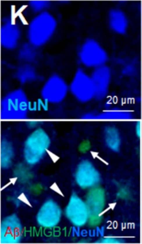 Cellular and subcellular localization of HMGB1 in the frontal cortices of 3.5 M Tg-APP/PS1 and age-matched control mice: Coronal brain sections were prepared from 3.5 M Tg (G–L) and age-matched control (A–F) mice, and triple-immunofluorescence staining was conducted with anti-A beta , anti-HMGB1, and anti-Iba1 (A–C,G–I) or anti-A beta , anti-HMGB1, and anti-NeuN (D–F,J–L) antibodies. Arrows indicate anti-HMGB1 immunoreactivity in microglia (B,C,H,I) or NeuN-negative cells (E,F,K,L). Arrowheads indicate anti-HMGB1 immunoreactivity in neurons (E,F,K,L) or Iba1-negative cells (H,I). The double arrow in (H) indicates anti-HMGB1 immunoreactivity in the cytoplasm of microglia, and the double arrowhead in (I) indicates anti-HMGB1 immunoreactivity in the cytoplasm of Iba1-negative cells (neurons). Scale bars represent 20 or 50 um. Image collected and cropped by CiteAb from the following open publication (//www.mdpi.com/2073-4409/13/2/189), licensed under a CC-BY license. Not internally tested by Novus Biologicals.