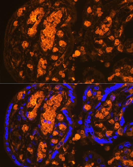 Immunocytochemistry/ Immunofluorescence Hemoglobin A2 Antibody - BSA Free