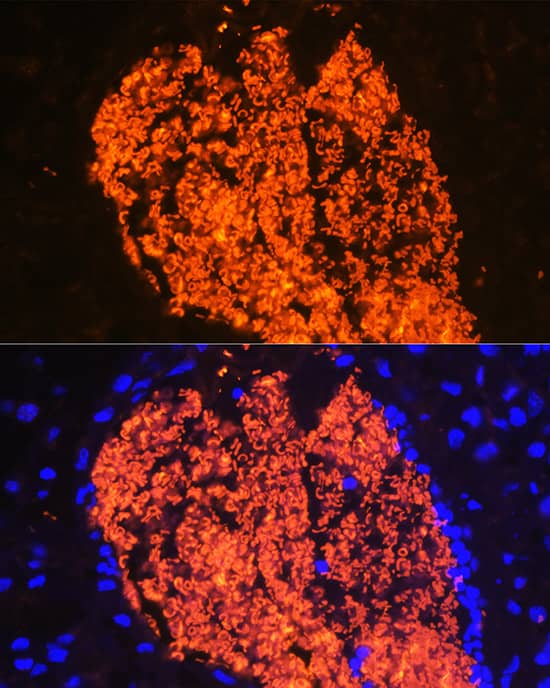 Immunocytochemistry/ Immunofluorescence: Hemoglobin A2 Antibody - BSA Free [NBP3-05569] - Immunofluorescence analysis of Mouse placenta using Hemoglobin A2 antibody  at dilution of 1:100 (40x lens). Blue: DAPI for nuclear staining.