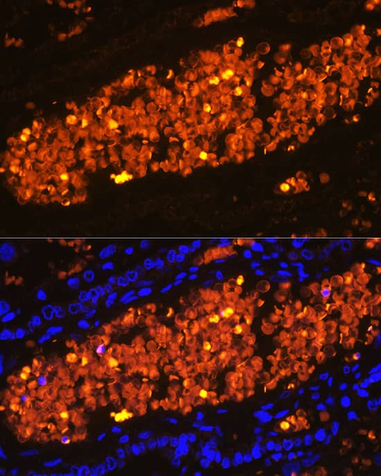 Immunocytochemistry/ Immunofluorescence Hemoglobin A2 Antibody - BSA Free