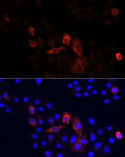 Immunocytochemistry/ Immunofluorescence: MT-ND2 Antibody - Azide and BSA Free [MT-ND2] - Immunofluorescence analysis of HeLa cells using MT-ND2 Rabbit pAb  at dilution of 1:100. Secondary antibody: Cy3-conjugated Goat anti-Rabbit IgG (H+L)  at 1:500 dilution. Blue: DAPI for nuclear staining.