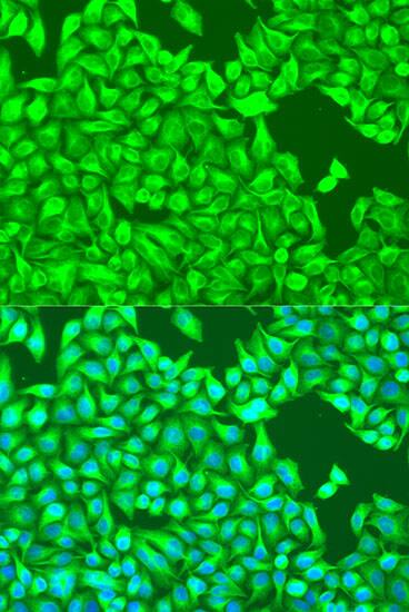 Immunocytochemistry/ Immunofluorescence: TUBB8 Antibody - BSA Free [TUBB8] - Immunofluorescence analysis of U2OS cells using TUBB8 Rabbit pAb  at dilution of 1:100. Secondary antibody: Cy3-conjugated Goat anti-Rabbit IgG (H+L)  at 1:500 dilution. Blue: DAPI for nuclear staining.