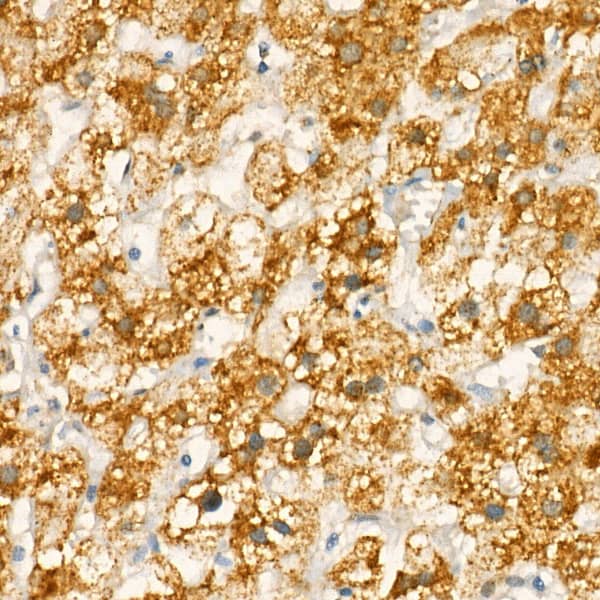 Immunohistochemistry: COX-1 Antibody - Azide and BSA Free [COX-1] - Immunohistochemistry analysis of paraffin-embedded Human liver using COX-1 Rabbit pAb  at dilution of 1:20 (40x lens). High pressure antigen retrieval performed with 0.01M Citrate Bufferr (pH 6.0) prior to IHC staining.