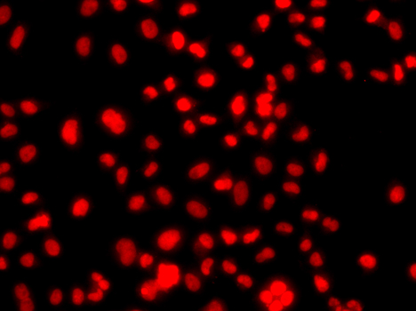 Immunocytochemistry/ Immunofluorescence PRICKLE2 Antibody - BSA Free