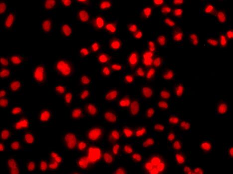 Immunocytochemistry/ Immunofluorescence PRICKLE2 Antibody - BSA Free