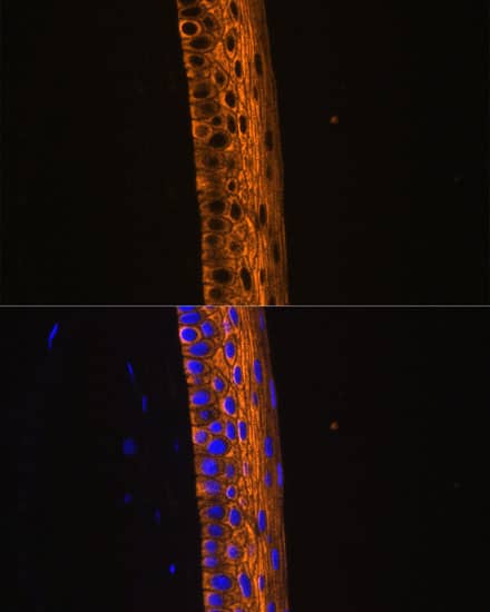 Immunocytochemistry/ Immunofluorescence: Myosin heavy chain 13 Antibody - Azide and BSA Free [NBP3-05614] - Immunofluorescence analysis of paraffin-embedded rat eye using Myosin heavy chain 13 Rabbit pAb  at dilution of 1:100 (40x lens). Secondary antibody: Cy3 Goat Anti-Rabbit IgG (H+L)  at 1:500 dilution. Blue: DAPI for nuclear staining.