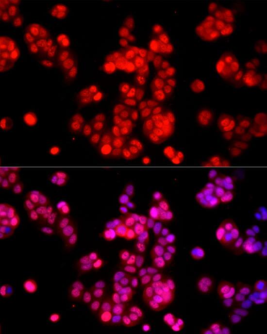 Immunocytochemistry/ Immunofluorescence: AMPK alpha 1/2 Antibody - Azide and BSA Free [AMPK alpha 1/2] - Immunofluorescence analysis of MCF7 cells using AMPK alpha 1/2 Rabbit pAb  at dilution of 1:20 (40x lens). Secondary antibody: Cy3-conjugated Goat anti-Rabbit IgG (H+L)  at 1:500 dilution. Blue: DAPI for nuclear staining.