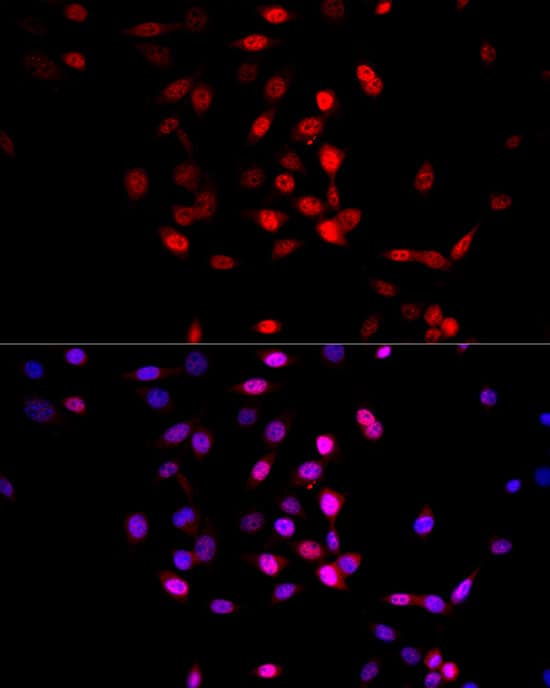 Immunocytochemistry/ Immunofluorescence: AMPK alpha 1/2 Antibody - Azide and BSA Free [AMPK alpha 1/2] - Immunofluorescence analysis of NIH/3T3 cells using AMPK alpha 1/2 Rabbit pAb  at dilution of 1:20 (40x lens). Secondary antibody: Cy3-conjugated Goat anti-Rabbit IgG (H+L)  at 1:500 dilution. Blue: DAPI for nuclear staining.