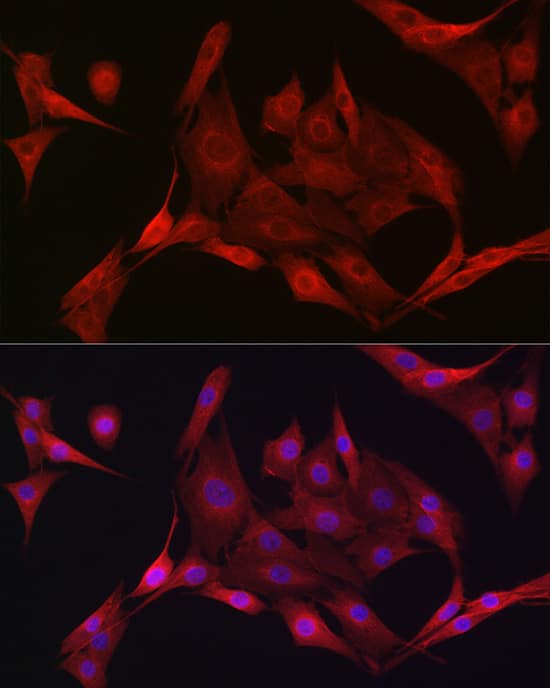 Immunocytochemistry/ Immunofluorescence: AMPK alpha 1/2 Antibody - Azide and BSA Free [NBP3-05635] - Immunofluorescence analysis of NIH/3T3 cells using AMPK alpha 1/2 Rabbit pAb  at dilution of 1:50 (40x lens). Blue: DAPI for nuclear staining.