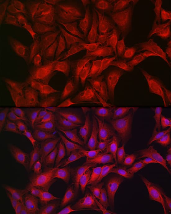 Immunocytochemistry/ Immunofluorescence: AMPK alpha 1/2 Antibody - Azide and BSA Free [NBP3-05635] - Immunofluorescence analysis of U2OS cells using AMPK alpha 1/2 Rabbit pAb  at dilution of 1:50 (40x lens). Blue: DAPI for nuclear staining.