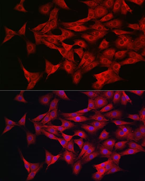 Immunocytochemistry/ Immunofluorescence: AMPK alpha 1/2 Antibody - Azide and BSA Free [NBP3-05635] - Immunofluorescence analysis of PC-12 cells using AMPK alpha 1/2 Rabbit pAb  at dilution of 1:50 (40x lens). Blue: DAPI for nuclear staining.