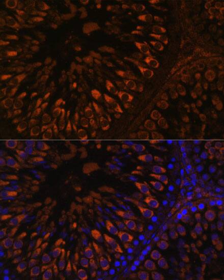 Immunocytochemistry/ Immunofluorescence: FER1L5 Antibody - Azide and BSA Free [NBP3-05642] - Immunofluorescence analysis of paraffin-embedded rat testis using FER1L5 Rabbit pAb  at dilution of 1:100. Secondary antibody: Cy3 Goat Anti-Rabbit IgG (H+L)  at 1:500 dilution. Blue: DAPI for nuclear staining.