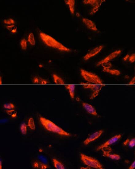 Immunocytochemistry/ Immunofluorescence: LRRC7 Antibody - Azide and BSA Free [NBP3-05643] - Immunofluorescence analysis of U-2 OS cells using LRRC7 Rabbit pAb  at dilution of 1:100. Secondary antibody: Cy3 Goat Anti-Rabbit IgG (H+L)  at 1:500 dilution. Blue: DAPI for nuclear staining.