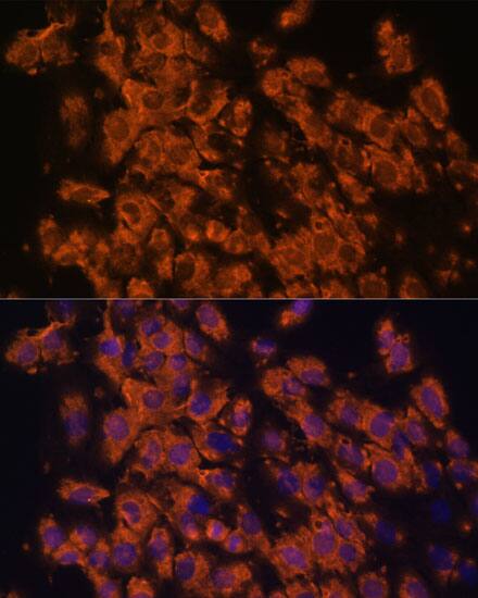Immunocytochemistry/ Immunofluorescence: LRRC7 Antibody - Azide and BSA Free [NBP3-05643] - Immunofluorescence analysis of C6 cells using LRRC7 Rabbit pAb  at dilution of 1:100. Secondary antibody: Cy3 Goat Anti-Rabbit IgG (H+L)  at 1:500 dilution. Blue: DAPI for nuclear staining.
