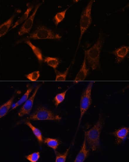 Immunocytochemistry/ Immunofluorescence: Creatine kinase MT 1B Antibody - Azide and BSA Free [NBP3-05655] - Immunofluorescence analysis of NIH-3T3 cells using Creatine kinase MT 1B Rabbit pAb (A3046) at dilution of 1:100 (40x lens). Secondary antibody: Cy3 Goat Anti-Rabbit IgG (H+L) (AS007) at 1:500 dilution. Blue: DAPI for nuclear staining.