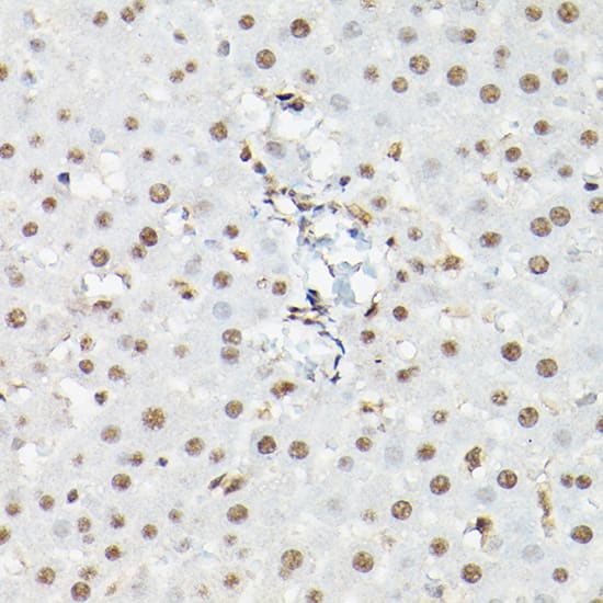 Immunohistochemistry: FOXO1A/3/4 Antibody - Azide and BSA Free [FOXO1A/3/4] - Immunohistochemistry analysis of paraffin-embedded mouse liver using FOXO1A/3/4 Rabbit pAb  at dilution of 1:50 (40x lens).Perform high pressure antigen retrieval with 10 mM citrate buffer pH 6.0 before commencing with IHC staining protocol.