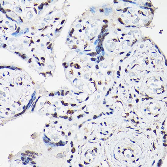 Immunohistochemistry: FOXO1A/3/4 Antibody - Azide and BSA Free [FOXO1A/3/4] - Immunohistochemistry analysis of paraffin-embedded human placenta using FOXO1A/3/4 Rabbit pAb  at dilution of 1:50 (40x lens).Perform high pressure antigen retrieval with 10 mM citrate buffer pH 6.0 before commencing with IHC staining protocol.