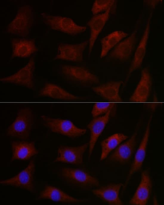 Immunocytochemistry/ Immunofluorescence: pan PKC Antibody - BSA Free [pan PKC] - Immunofluorescence analysis of NIH-3T3 cells using pan PKC Rabbit pAb  at dilution of 1:100 (40x lens). Secondary antibody: Cy3 Goat Anti-Rabbit IgG (H+L)  at 1:500 dilution. Blue: DAPI for nuclear staining.