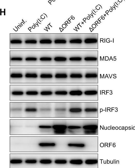 Western Blot SARS-CoV-2 ORF6 Antibody - BSA Free