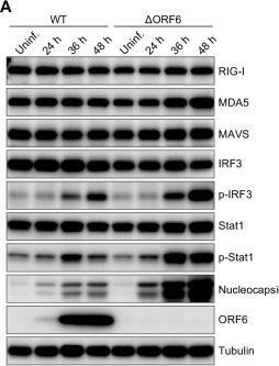 Western Blot SARS-CoV-2 ORF6 Antibody - BSA Free