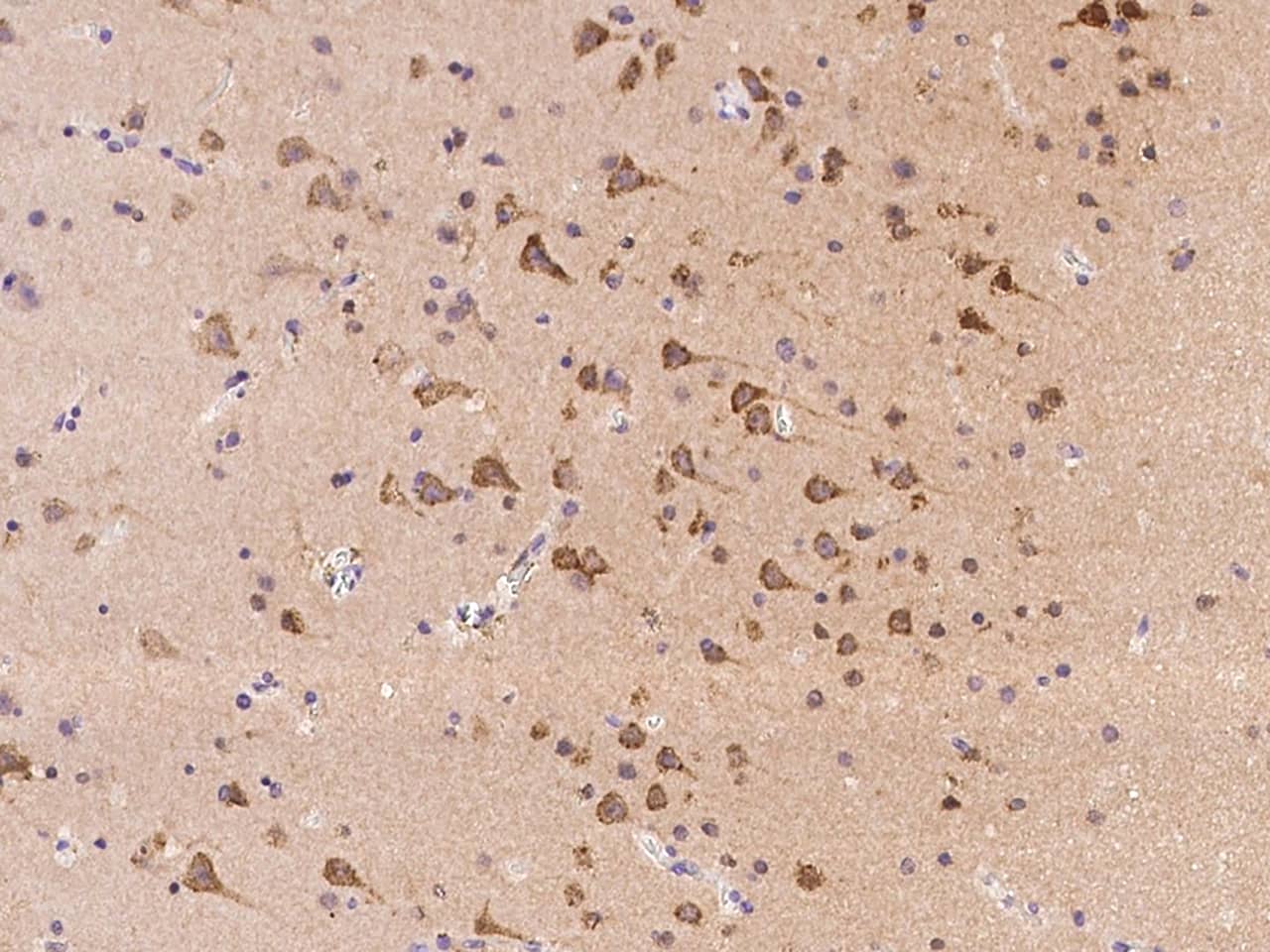Immunohistochemistry-Paraffin RNF180 Antibody - BSA Free