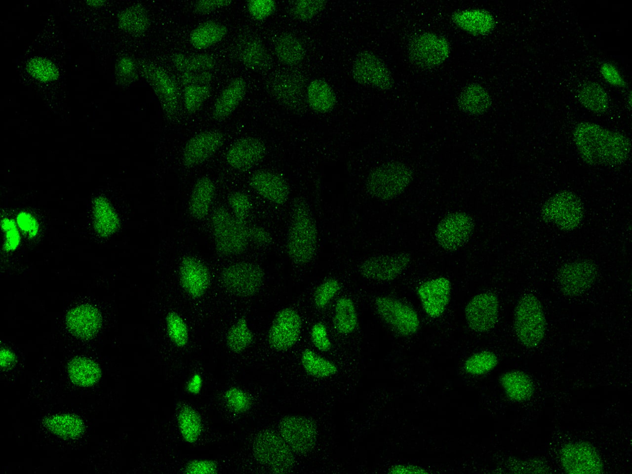 Immunocytochemistry/ Immunofluorescence: PROSER1 Antibody - BSA Free [NBP3-05784] - Immunofluorescence staining of PROSER1 in Caco2 cells. Cells were fixed with 4% PFA, permeabilzed with 0.3% Triton X-100 in PBS,blocked with 10% serum, and incubated with NBP3-05784 (dilution ratio 1:200) at 4 overnight. Then cells were stained with the Alexa Fluor488-conjugated Goat Anti-rabbit IgG secondary antibody (green). Positive staining was localized to Nucleus.