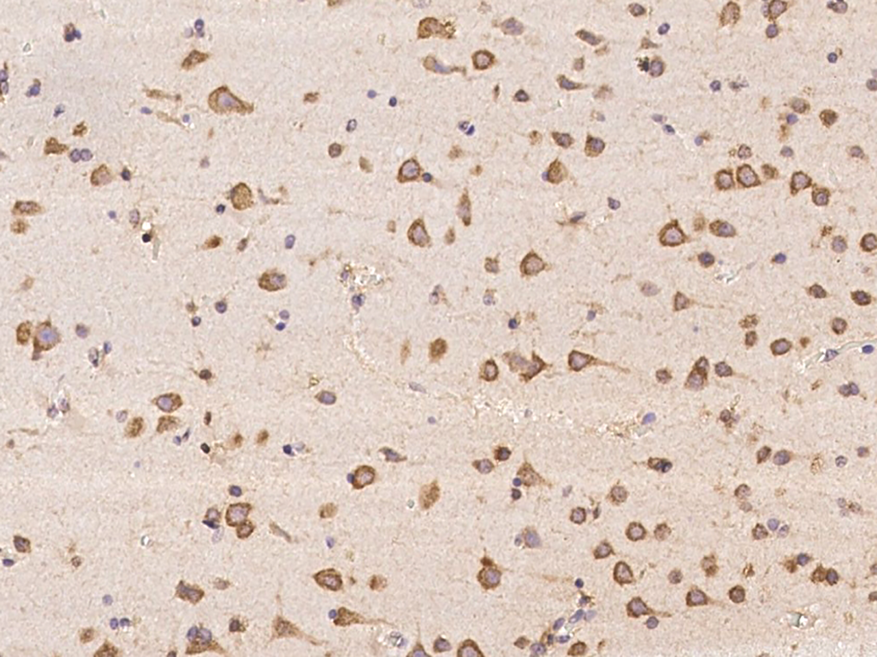 Immunohistochemistry-Paraffin: ABCA10 Antibody - BSA Free [NBP3-05791] - Immunochemical staining of human ABCA10 in human brain with NBP3-05791 at 1:500 dilution, formalin-fixed paraffin embedded sections.