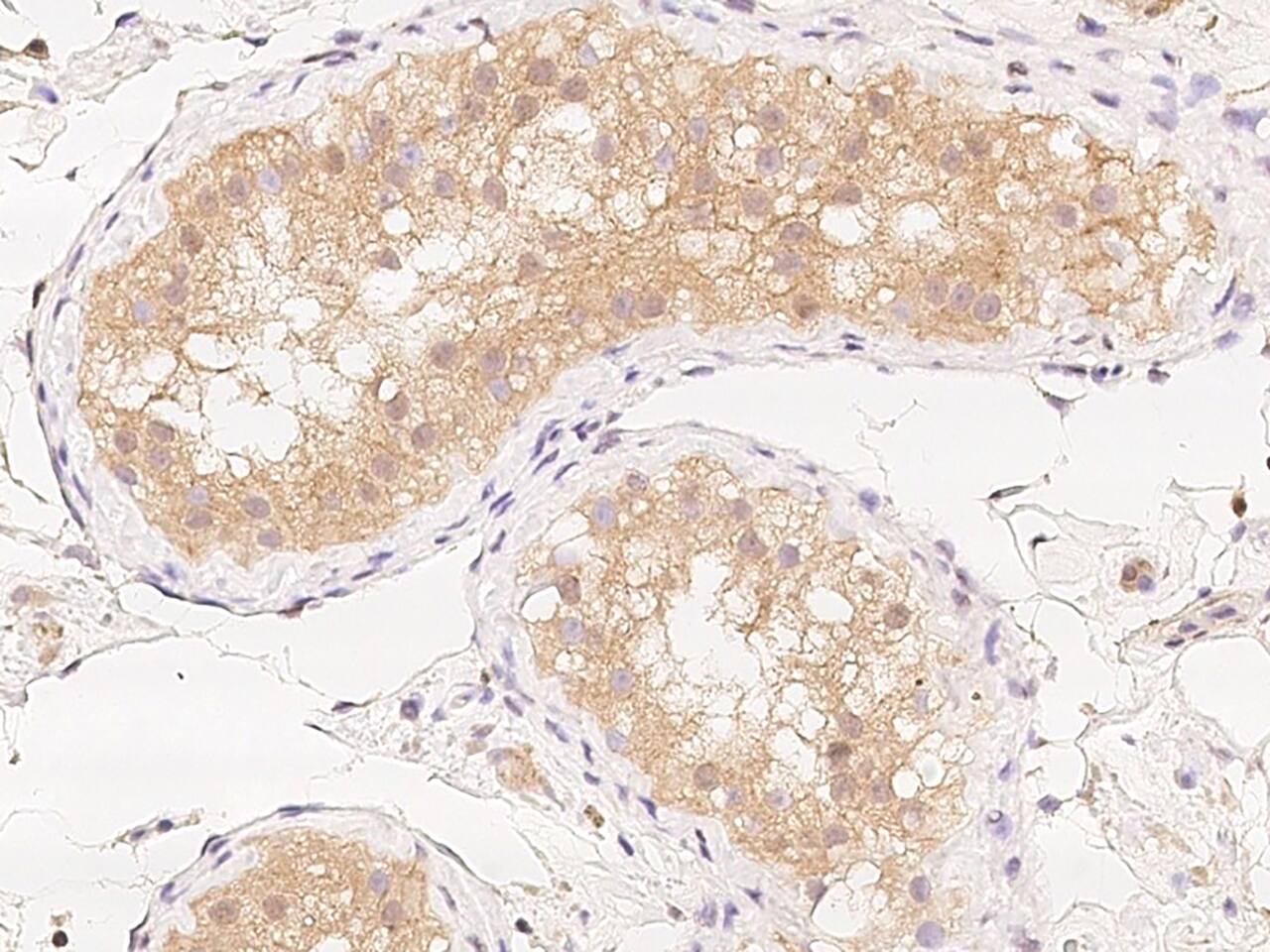 Immunohistochemistry-Paraffin: ZNF804B Antibody - BSA Free [NBP3-05793] - Immunochemical staining of human ZNF804B in human testis with NBP3-05793 at 1:100 dilution, formalin-fixed paraffin embedded sections.