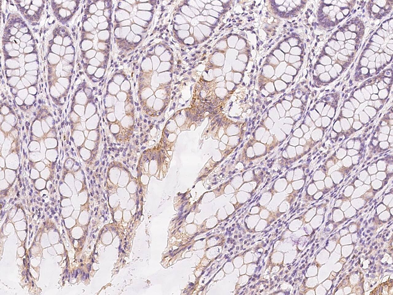 Immunohistochemistry-Paraffin: RGL4 Antibody - BSA Free [NBP3-05804] - Immunochemical staining of human RGL4 in human rectum with NBP3-05804 at 1:100 dilution, formalin-fixed paraffin embedded sections.