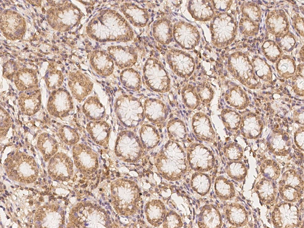 Immunohistochemistry-Paraffin: CLN6 Antibody - BSA Free [NBP3-05809] - Immunochemical staining of human CLN6 in human stomach with NBP3-05809 at 1:100 dilution, formalin-fixed paraffin embedded sections.