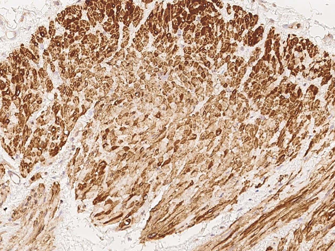 Immunohistochemistry-Paraffin: ENOX2 Antibody - BSA Free [NBP3-05824] - Immunochemical staining of human ENOX2 in human smooth muscle with NBP3-05824 at 1:100 dilution, formalin-fixed paraffin embedded sections.