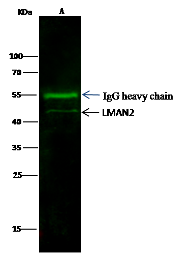 Immunoprecipitation: LMAN2 Antibody (02) [NBP3-05830] - LMAN2-His was immunoprecipitated using: Lane A:0.5 mg Hela Whole Cell Lysate 2 uL NBP3-05830 and 15 ul of 50 % Protein G agarose. Primary antibody: NBP3-05830, at 1:100 dilution. Secondary antibody: Dylight 800-labeled antibody to Mouse IgG (H+L), at 1:7500 dilution. Developed using the odssey technique. Performed under reducing conditions. Predicted band size: 40 kDa Observed band size: 40 kDa 