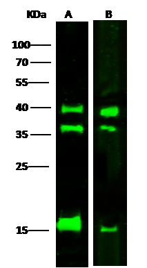 Western Blot: LMAN2 Antibody (02) [NBP3-05830] - NBP3-05830 at 1:500 dilution Lane A: Jurkat Whole Cell Lysate Lane B: Hela Whole Cell Lysate Lysates/proteins at 30 ug per lane. Secondary Goat Anti-Mouse IgG H&L (Dylight800) at 1/15000 dilution. Developed using the Odyssey technique. Performed under reducing conditions. Predicted band size:40 kDa Observed band size:40 kDa (We are unsure as to the identity of these extra bands.) 