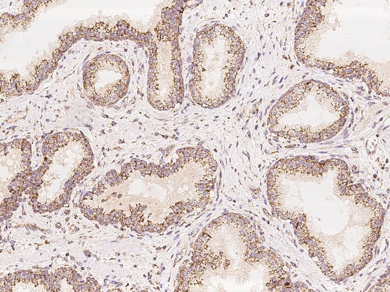 Immunohistochemistry-Paraffin: COQ2 Antibody - BSA Free [NBP3-05834] - Immunochemical staining of human COQ2 in human prostate with NBP3-05834 at 1:100 dilution, formalin-fixed paraffin embedded sections.
