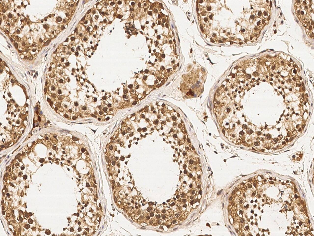 Immunohistochemistry-Paraffin: DZIP1 Antibody (05) [NBP3-05837] - Immunochemical staining of human DZIP1 in human testis with NBP3-05837 (1:200, formalin-fixed paraffin embedded sections).