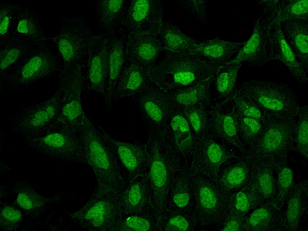 Immunocytochemistry/ Immunofluorescence: ATP8B4 Antibody - BSA Free [NBP3-05855] - Immunofluorescence staining of ATP8B4 in U2OS cells. Cells were fixed with 4% PFA, permeabilzed with 0.3% Triton X-100 in PBS,blocked with 10% serum, and incubated with NBP3-05855 (dilution ratio 1:200) at 4 overnight. Then cells were stained with the Alexa Fluor488-conjugated Goat Anti-rabbit IgG secondary antibody (green). Positive staining was localized to Nucleus and Cytoplasm.
