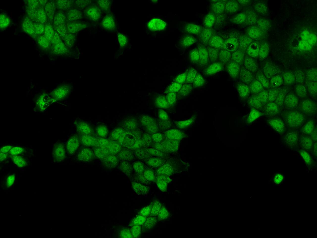 Immunocytochemistry/ Immunofluorescence CCDC141 Antibody - BSA Free