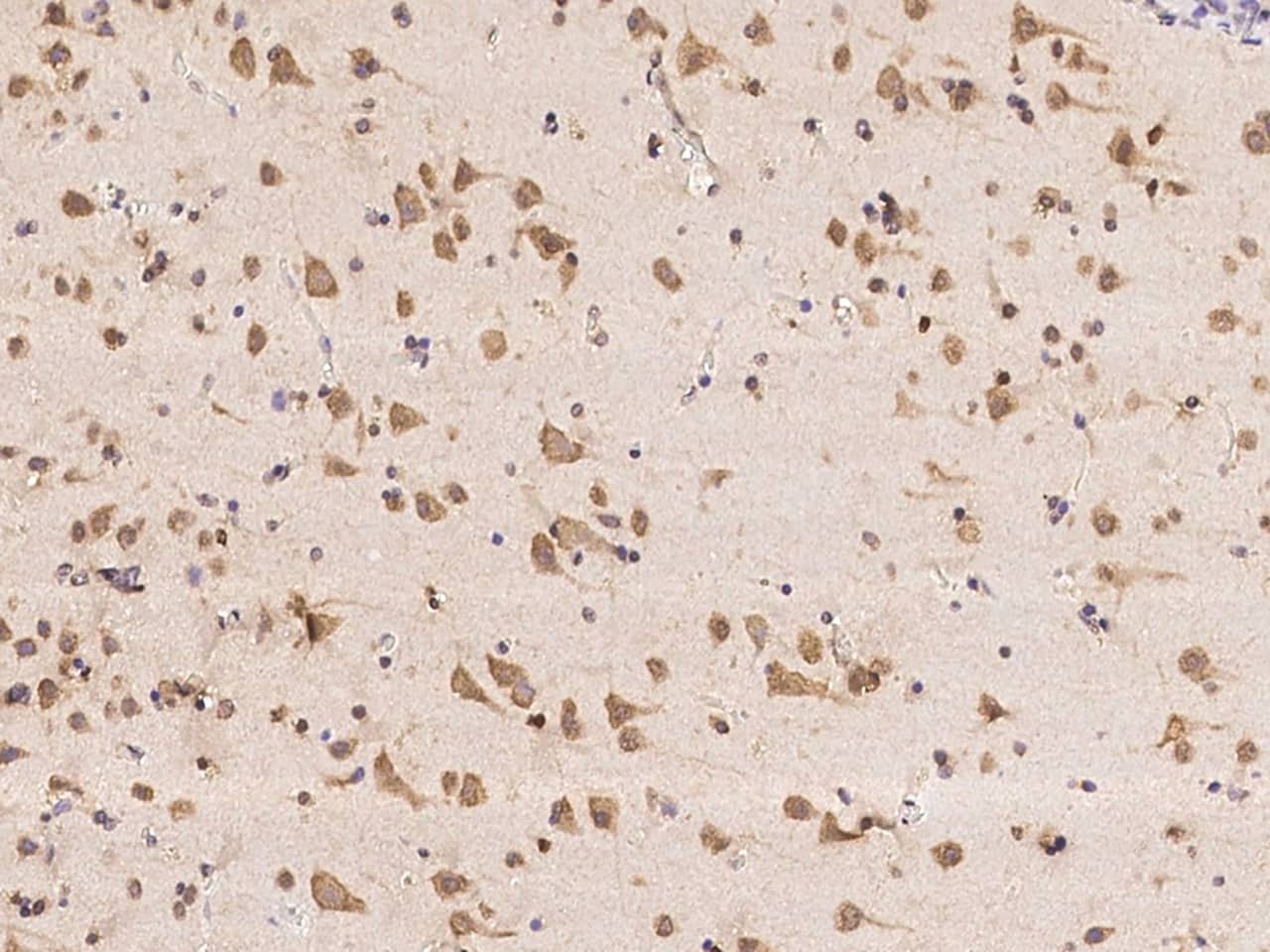 Immunohistochemistry-Paraffin: Huntingtin Interacting Protein K Antibody - BSA Free [NBP3-05862] - Immunochemical staining of human Huntingtin Interacting Protein K in human brain with NBP3-05862 at 1:500 dilution, formalin-fixed paraffin embedded sections.