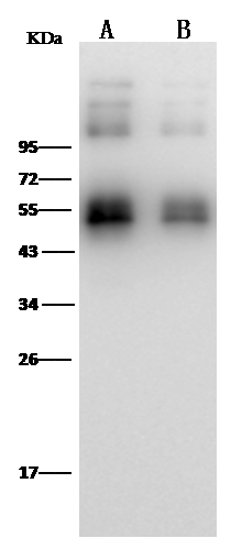 Western Blot Zika Virus (SPH2015) NS1 Antibody (15) - Azide and BSA Free