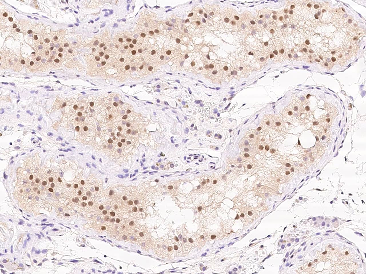 Immunohistochemistry-Paraffin: TSG-9 Antibody - BSA Free [NBP3-05875] - Immunochemical staining of human TSG-9 in human testis with NBP3-05875 at 1:100 dilution, formalin-fixed paraffin embedded sections.