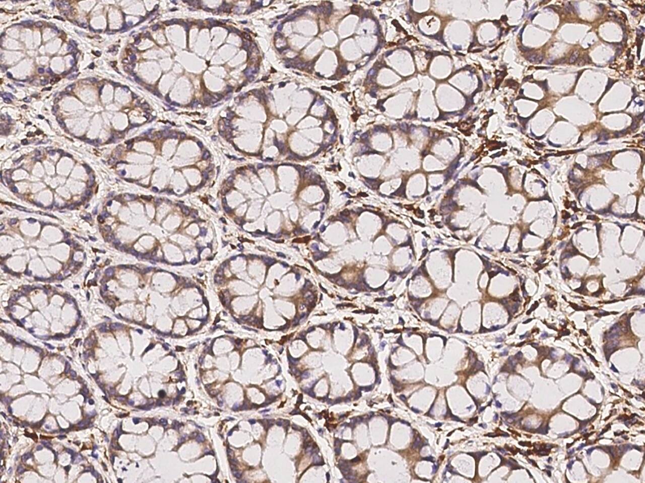 Immunohistochemistry-Paraffin: FAM188B Antibody - BSA Free [NBP3-05876] - Immunochemical staining of human FAM188B in human rectum with NBP3-05876 at 1:100 dilution, formalin-fixed paraffin embedded sections.