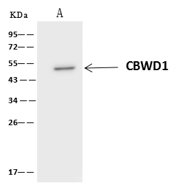 Immunoprecipitation: CBWD1 Antibody - BSA Free [NBP3-05877] - CBWD1 was immunoprecipitated using: Lane A:0.5 mg U-87 MG U-251 MG Whole Cell Lysate 4 uL NBP3-05877 and 60 ug of Immunomagnetic beads Protein A/G. Primary antibody: NBP3-05877, at 1:100 dilution. Secondary antibody: IP Detection Reagent (HRP) at 1:1000dilution. Developed using the ECL technique. Performed under reducing conditions. Predicted band size: 44 kDa Observed band size :50 kDa 