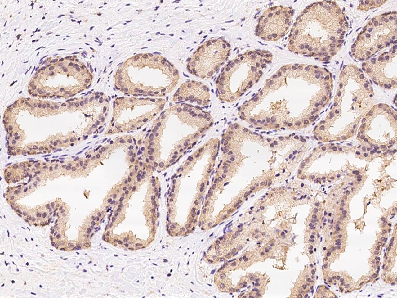 Immunohistochemistry-Paraffin: CBWD1 Antibody - BSA Free [NBP3-05877] - Immunochemical staining of human CBWD1 in human prostate with NBP3-05877 at 1:100 dilution, formalin-fixed paraffin embedded sections.